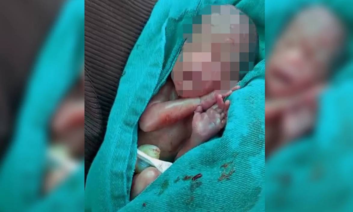 Morre recém-nascido prematuro retirado vivo no próprio velório