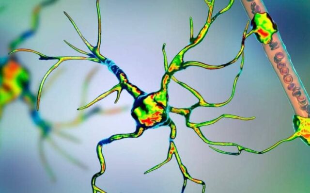 ELA, doença degenerativa que destrói neurônios motores e leva à morte