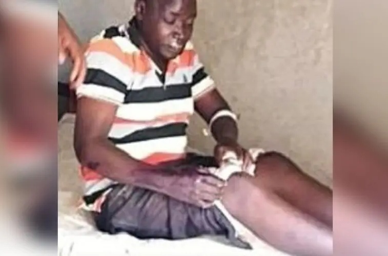 Pastores são agredidos por extremistas em Uganda