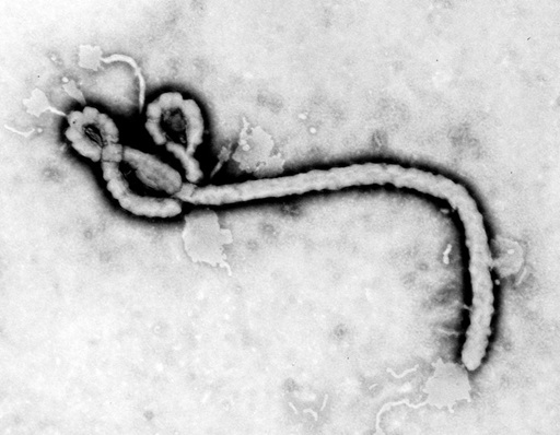 Médico é o 1º caso de ebola na França