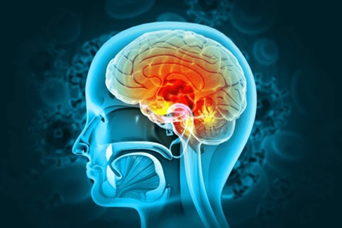 Letalidade por meningite no Brasil varia entre 20% e 30% em 2026