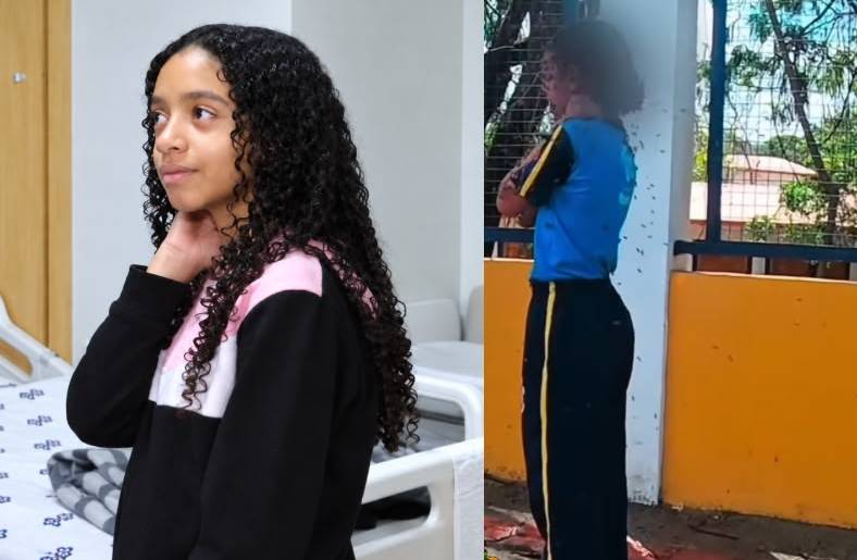 Menina atacada por abelhas recebe alta após uma semana internada